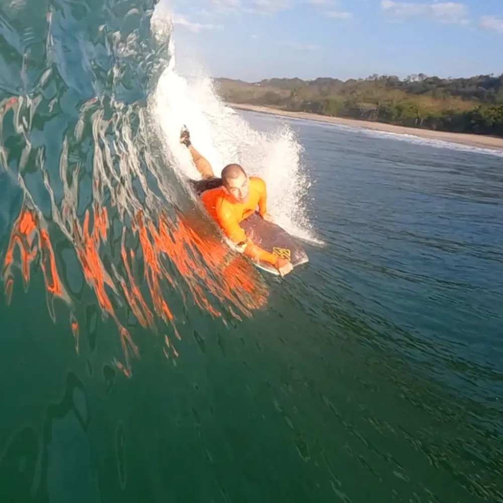 Bodyboarding Injuries
